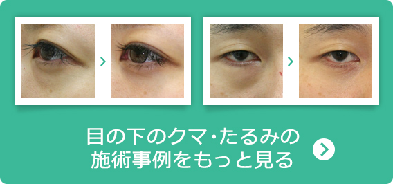目の下のくま・たるみの施術事例をもっと見る