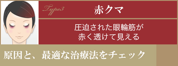 赤クマ