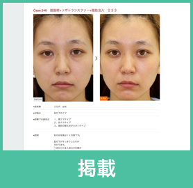 掲載